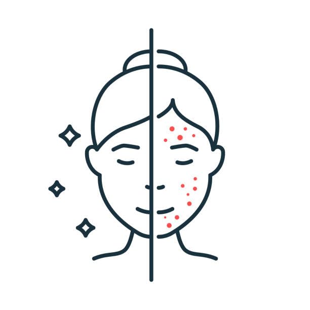 Yellow Stars Acne Patches, Hydrocolloid Pimple Patch For Face, 28 Count, All Skin Types