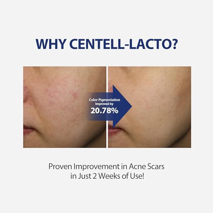 SUNGBOON EDITOR Centell Lacto AC Less Skin Barrier Serum | Probiotic & Niacinamide Face Serum for Sensitive, Blemish-Prone Skin | Lightweight, Non-Greasy Hydrating Korean Skincare
