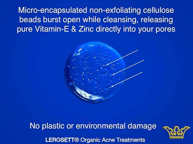 LEROSETTยฎ Clear Skin Face Wash โ Gentle Gel Cleanser with 60% Aloe-Rich Botanicals, 4% Glycolic Acid & Vit-E Microbeads โ Fights Breakouts, Unclogs Pores, Balances Oil โ Spa-Grade, Vegan โ 4oz
