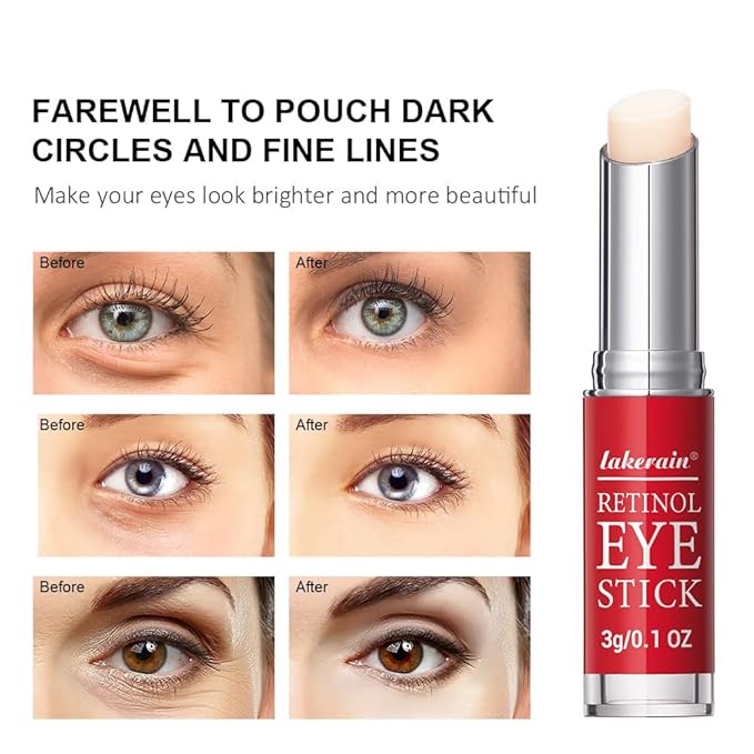 Retinol Eye Stick, Retinol Eye Cream With Collagen,Hyaluronic Acid For Dark Circle, Wrinkles, Under Eye Cream Anti Aging, Retinol Eye Balm Reduces Puffiness Fine Lines, Visible Results in 3-4 Weeks