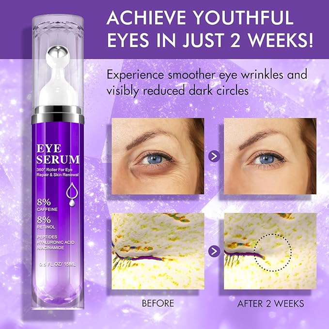 Eye Serum for Dark Circles and Puffiness, Under Eye Cream Anti Aging for Puffiness and Bags with 360ยฐ Eye Roller Massage Ball, Eye Serum with 8% Caffeine 8% Retinol for Women & Men