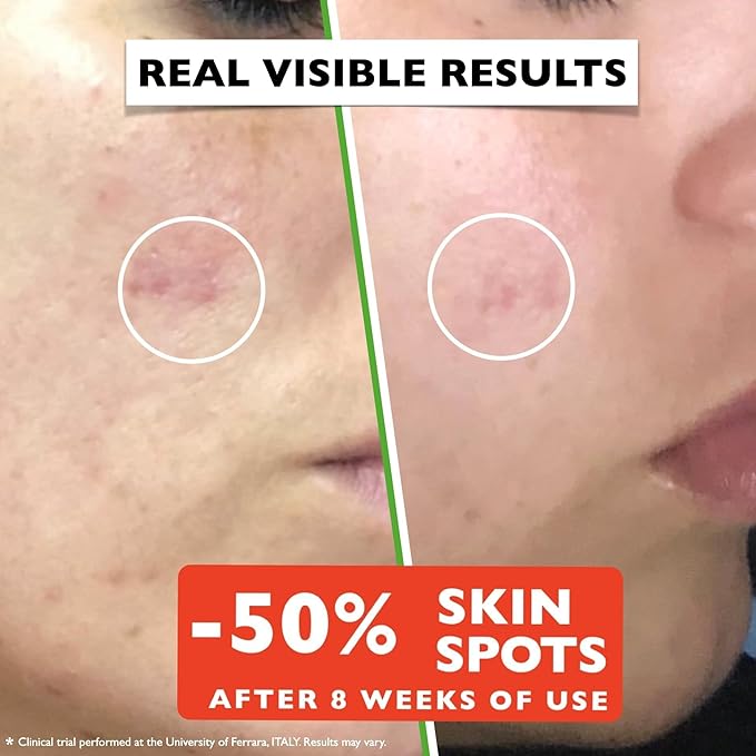 Vitamin C Serum For Face โ Anti-Aging Facial Serum with Vitamin C, Hyaluronic Acid, Niacinamide, B5 & Vit E. Brightening Facial Essence for Dark Spots, Fine Lines, Wrinkles & Glowing Skin, 2 Fl Oz