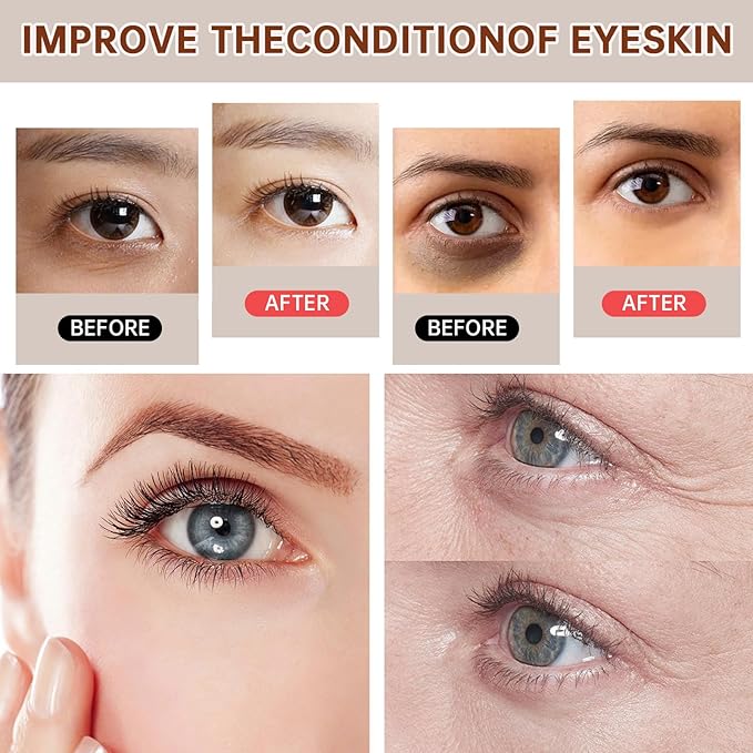 The Caffeine Solution 5% + EGCG,Reduces Appearance of Eye Contour Pigmentation and Puffiness,Under Eye Serum (30ml) Caffeine For Face Moisturizing Serum (1)