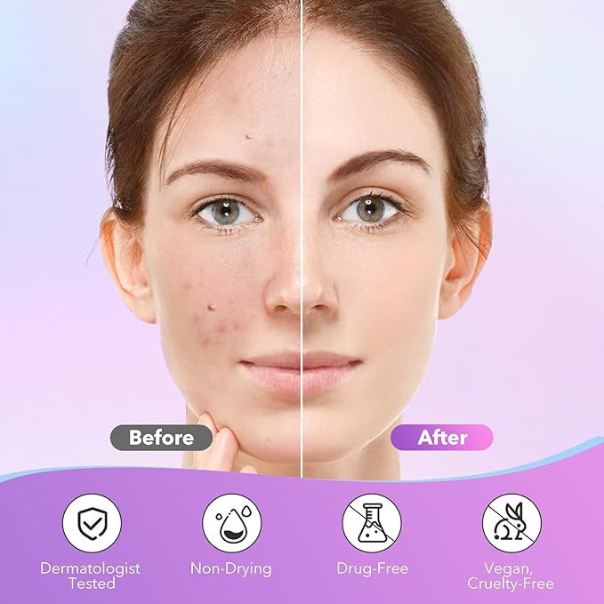 Pimple Patches for Face, Hydrocolloid Acne Patches, Cute Star Zit Covers for Face, Colorful Spot Stickers with Tea Tree, Salicylic Acid & Cica Oil| 3 Sizes (10mm, 12mm & 14mm) |280 Count