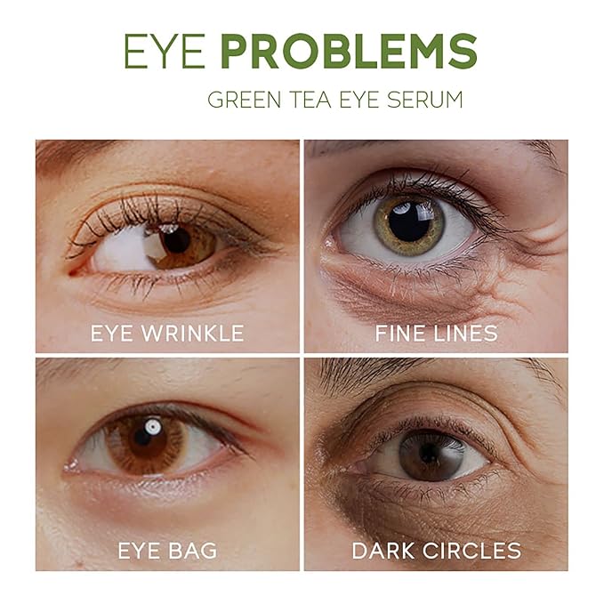 AKARY Green Tea Eye Serum and Under Eye Roller Cream, for Eye Bags Puffiness, Caffeine Eye Cream with 360ยฐ Massage Ball Reduce Wrinkles and Fine Lines, Under Eyes, Moisturizing, Hydrating, Firming Eye Skin (Green Tea)