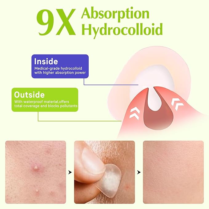Pimple Patches For Face, Invisible Hydrocolloid Acne Patches Acne Treatment,Covering Zits & Blemishes in Skin and Face, Zit Patches with Salicylic Acid, FSA HSA Store Eligible Items 144 Count