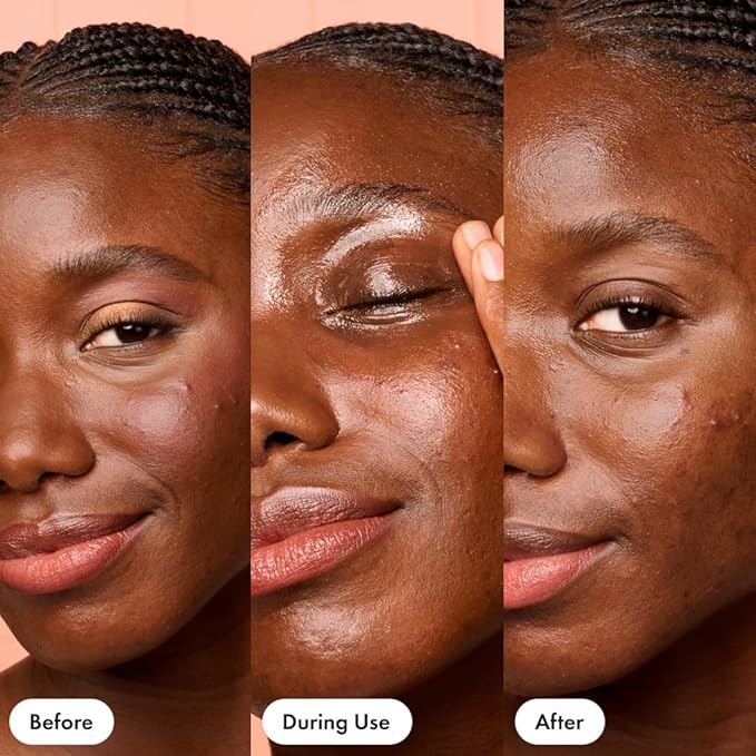 HERO COSMETICS Dissolve Away Daily Cleansing Balm - Helps Remove Makeup and Grime - Wonโt Clog Pores - Suitable for Sensitive and Acne-Prone Skin (2.2 fl oz)