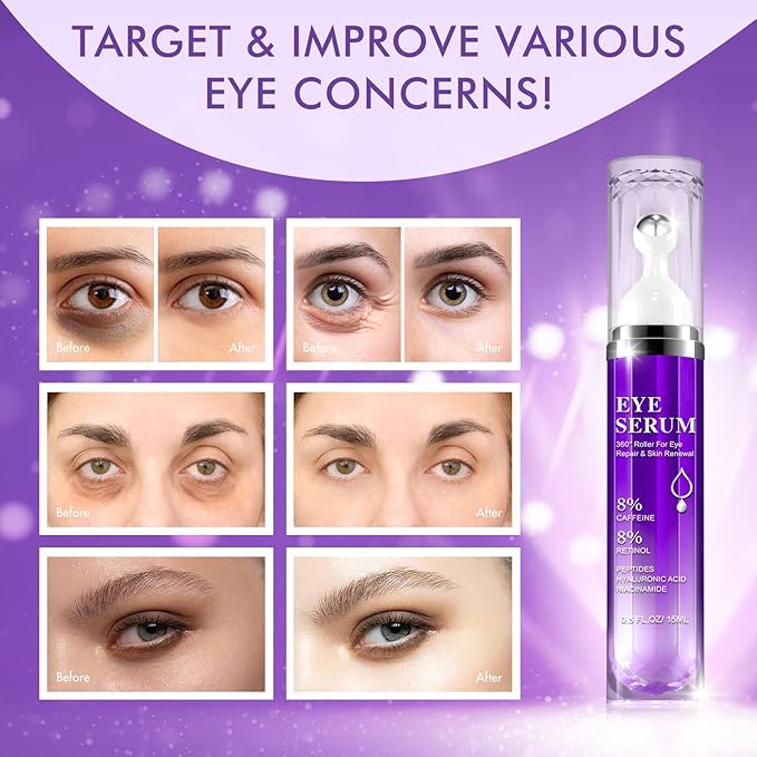 Eye Serum for Dark Circles and Puffiness, Under Eye Cream Anti Aging for Puffiness and Bags with 360ยฐ Eye Roller Massage Ball, Eye Serum with 8% Caffeine 8% Retinol for Women & Men