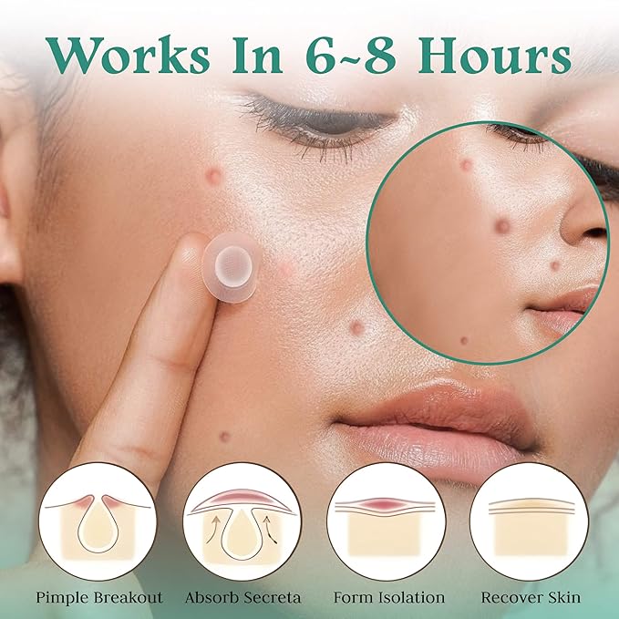 Advanced Invisible Pimple Patches For Face (36 Pack) - Hydrocolloid Patch with Tea Tree Oil - Vegan Friendly Hydrocolloid Acne Patches For Face and Skin - Pimple Patch Stickers - Acne Patch (12mm)