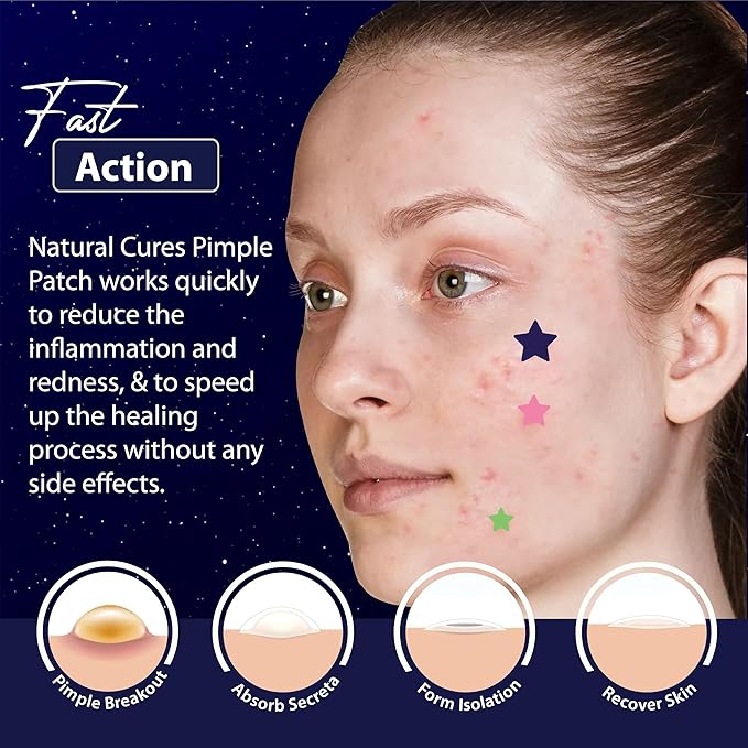 Star Pimple Patches for Face โ Hydrocolloid Acne Patches for Quick Zit Relief and Blemishes, Invisible Spot Stickers That Stay All Night, Gentle for All Skin Types, Oil-Free (240 Count)