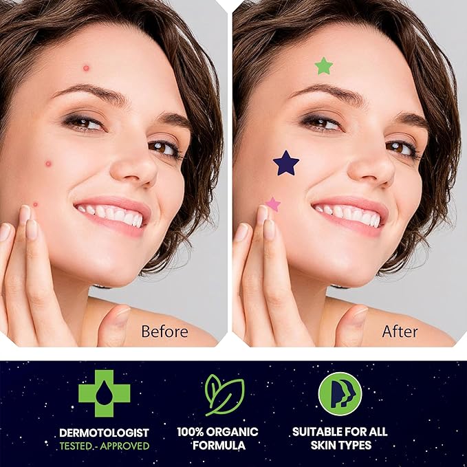 Star Pimple Patches for Face โ Hydrocolloid Acne Patches for Quick Zit Relief and Blemishes, Invisible Spot Stickers That Stay All Night, Gentle for All Skin Types, Oil-Free (240 Count)