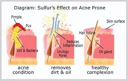 JOESOEF SKIN CARE Sulfur Soap Acne