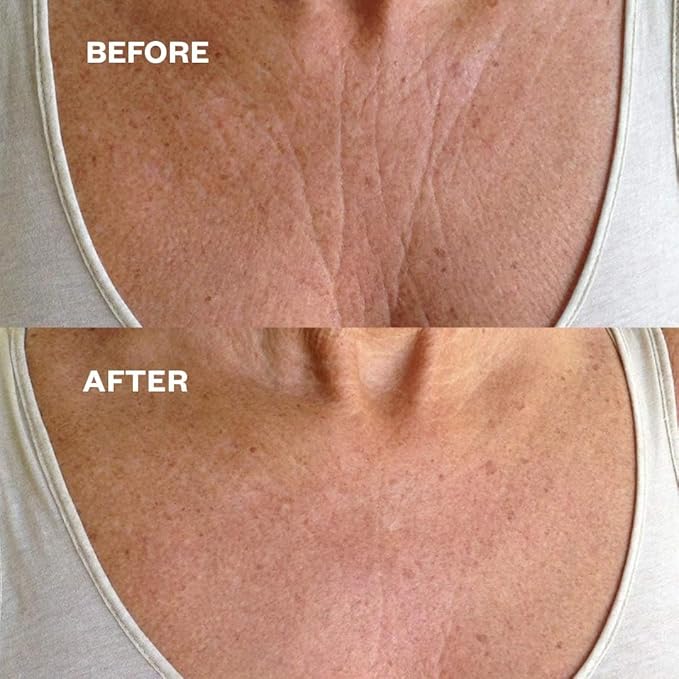 Wrinkles Schminkles Chest, Cleavage & Body Smoothing