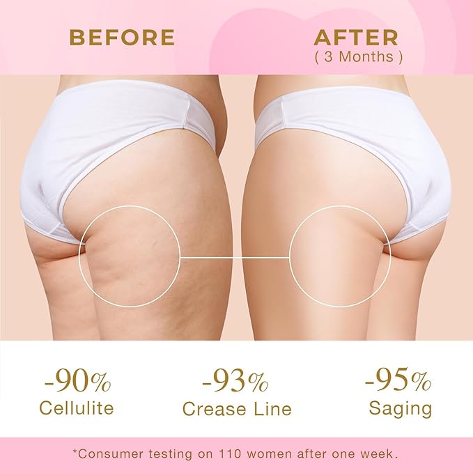 Cellulite Cream for Body Firming: Booty