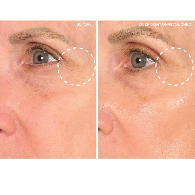 SiO Beauty Eye and Smile SuperLift - Eye & Lip Anti-Wrinkle Silicone Patches - Reduce Smile and Under Eye Wrinkles Overnight
