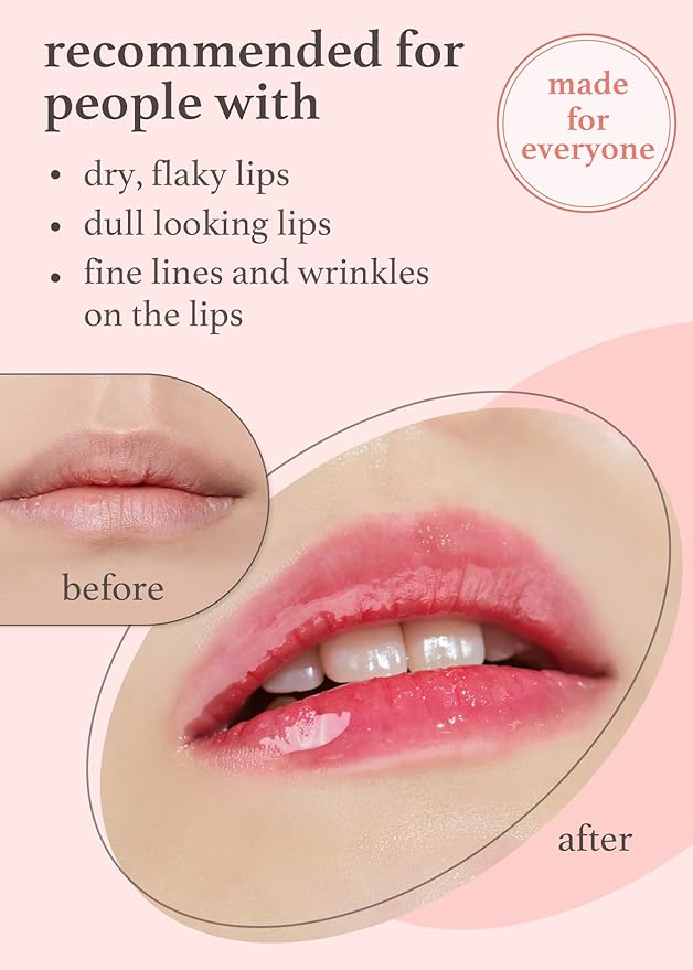 NOONI Korean Lip Oil - Applepeony | Lip