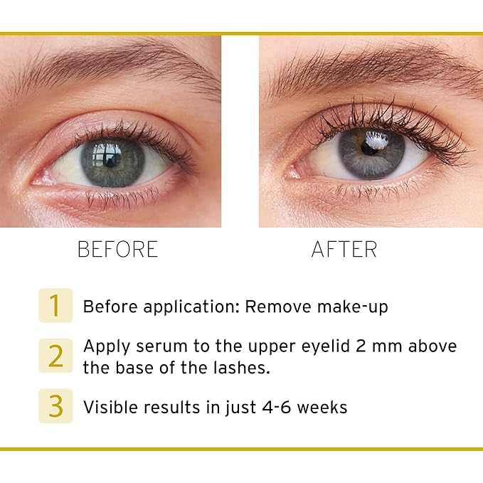Nutralash ADVANCED Eyelash Formula - Lash Serum for Longer Eyelashes in Just 4-6 Weeks I Eyelash Growth Serum I Made in Germany I 3ml
