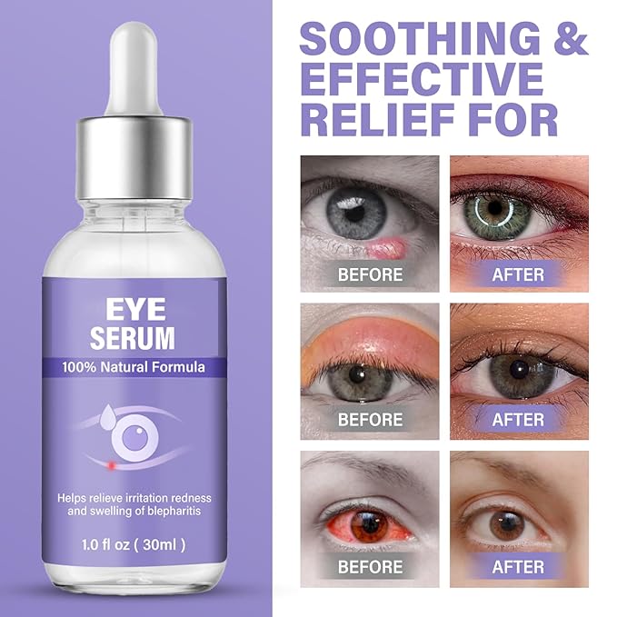 Eye serum, mild eye treatment