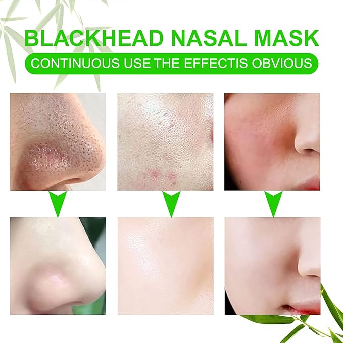 Blackhead Remover Strips,Remover Pore Strips (80pcs),Deep Cleansing Nose Strips,Removes Blackheads and Unclogs Pores,Tightens Pores, Blackhead Remover Strips For Women and Men