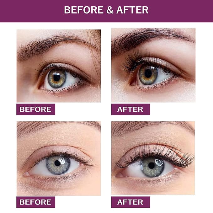 EYELASH Growth Serum for Longer Fuller Healthier Eyelashes and Brows Natural Formula 5ML (5ML, Count, 1)