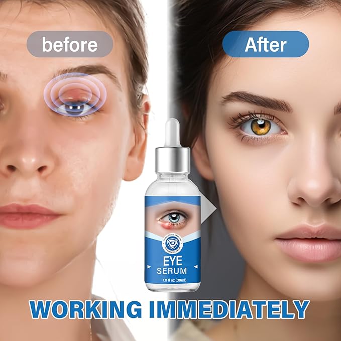 Eye treatment, effective eye serum