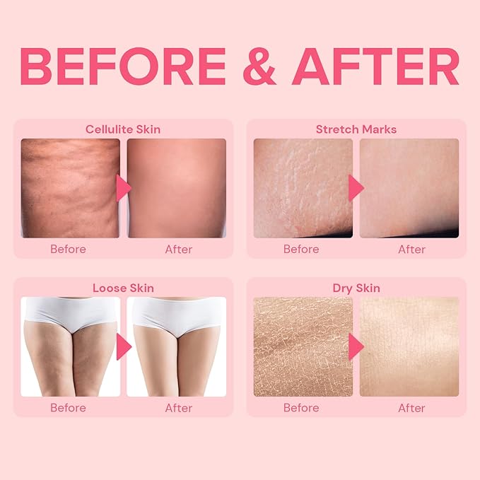 Inner Thighs Skin Firming Cream: Anti-Cellulite 100ML