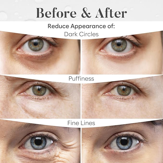 Snail Mucin Under Eye Patches (30 PAIRS), For Puffy Eyes and Dark Circles, Under Eye Mask with Hyaluronic Acid & Hydrolyzed Collagen, Deeply Hydrating Formula, Patch Yeux
