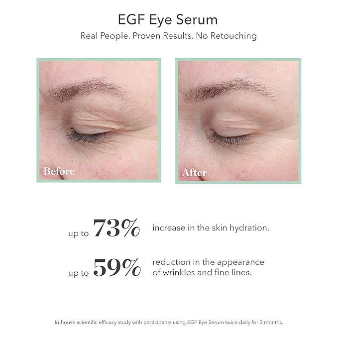 Bioeffect egf eye serum with