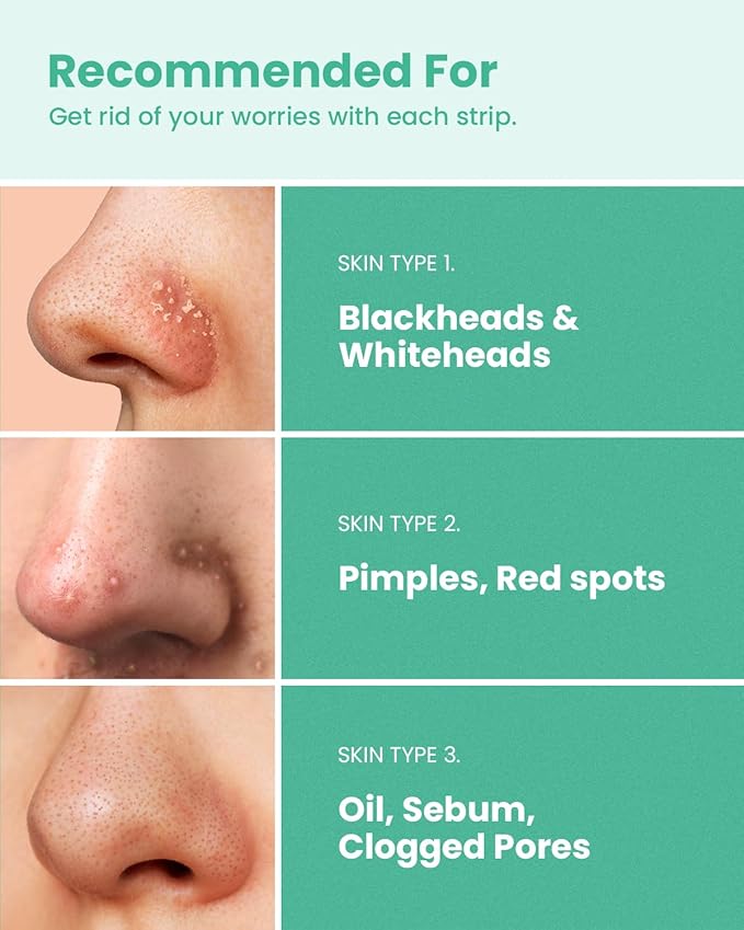 GLAM UP Spotless Nose Patch Hydrocolloid Coverage for Nose Pores, Zits and Oil - Overnight Strong Waterproof to Absorb Blackheads & Pimple Nose Gunk, and Calm with Tea Tree (12 Patches)