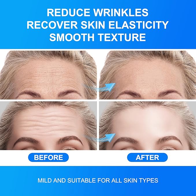 Forehead Wrinkle Patches Overnight 14pcs with Collagen & Vitamin E, Anti Wrinkle Patches for Forehead Filler & Deep Line Treatment, jelly forehead patches for Gentle Skin Care Solution