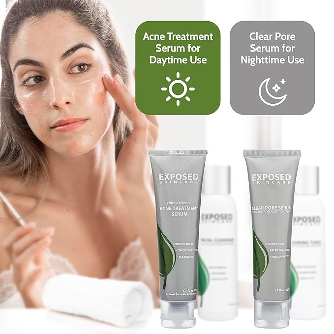 Exposed Skin Care Basic Acne Treatment Kit - Includes Salicylic Acid Face Wash, Clearing Tonic, Acne Treatment Serum with Benzoyl Peroxide, Clear Pore Serum - Acne Set Solution for All Skin Types