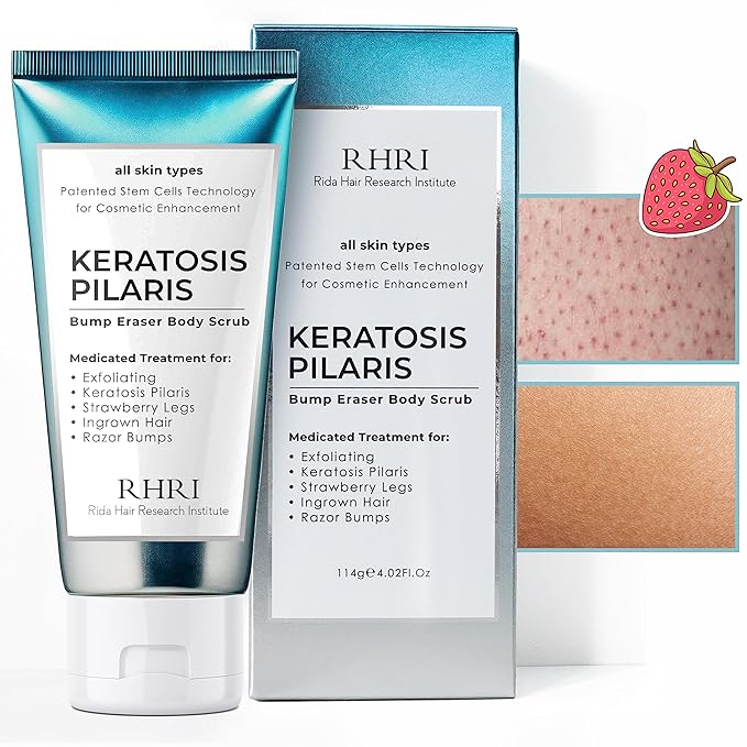 KP Bump Eraser Body Scrub, Keratosis